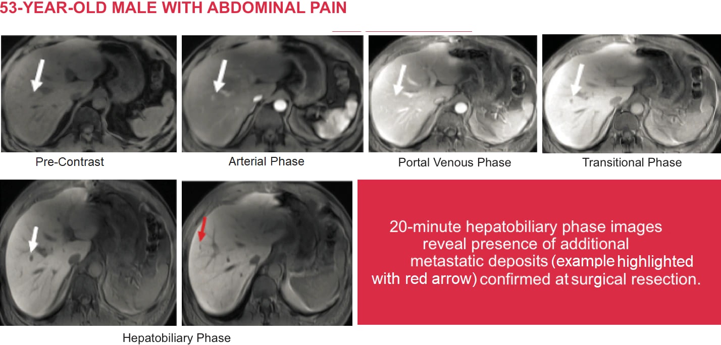 Eovistinjection Radiology Global Master V1